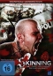 Preview: Skinning - Wir sind das Gesetz - (Vermietrecht)