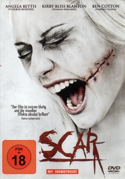 Scar - (Vermietrecht)